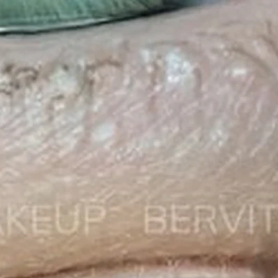 Bervitskaya_pm
