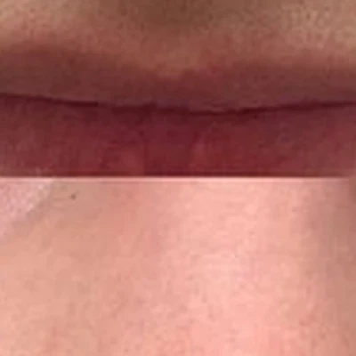 Epilux clinic