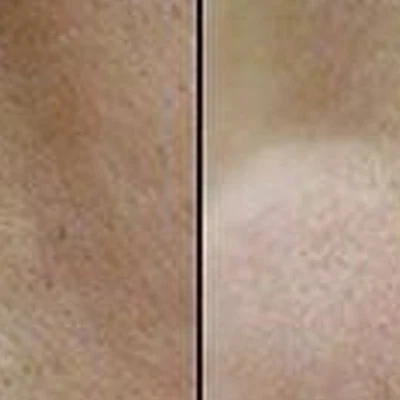 Beauty innovatione epil