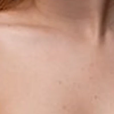 Baby skin
