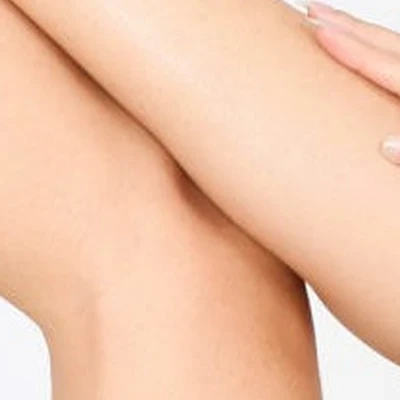 Лазерная эпиляция Строитель