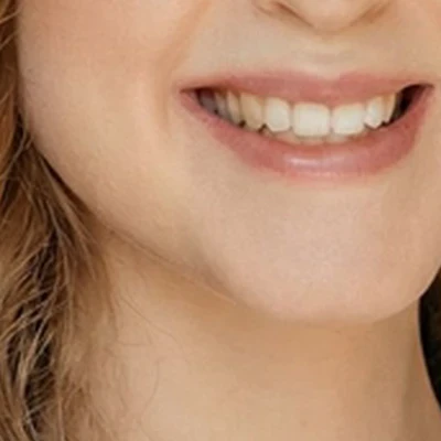 VELVET TOUCH. Студия бережного удаления волос.