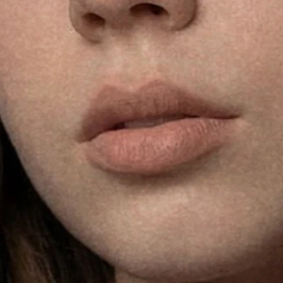 TVOYA студия электроэпиляции и депиляции