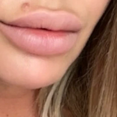 &