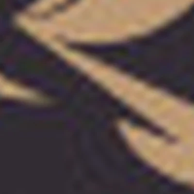 Лазерная эпиляция