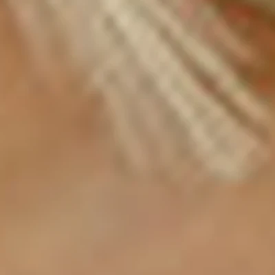 Epilbody