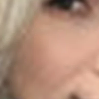 Альбина
