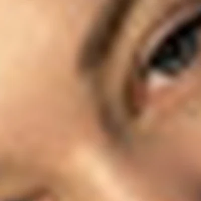 lash_skintey