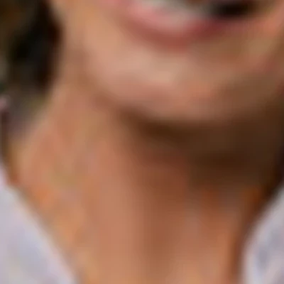 Лазерная эпиляция Имидж