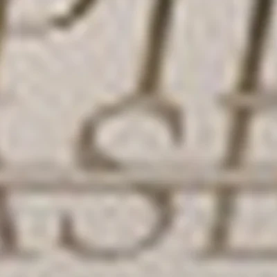Epil_laser_SD