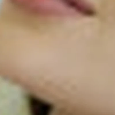 NEKTARIN