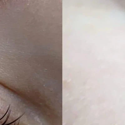 Lash magic