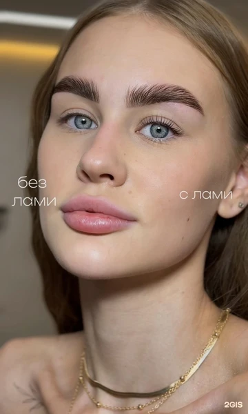 &