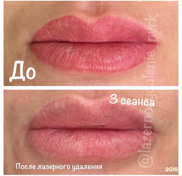 &