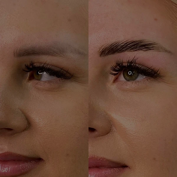 &