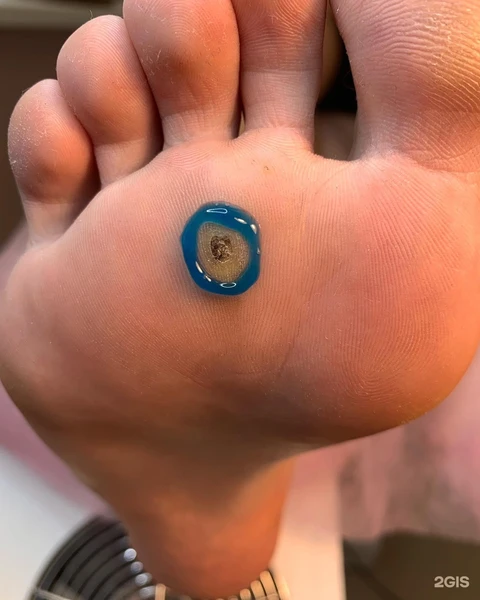 &