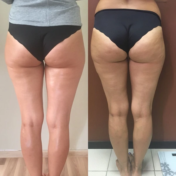 &