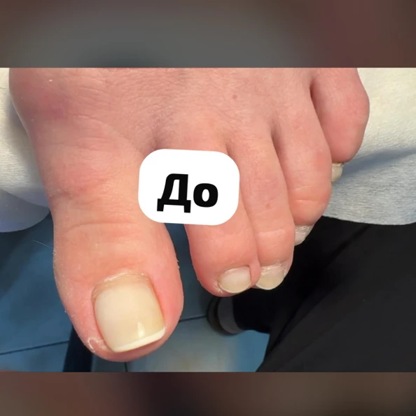 &