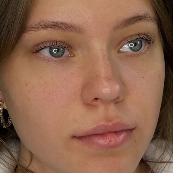 &