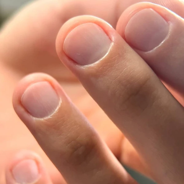 &