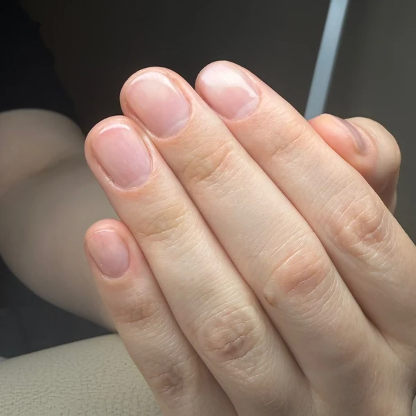 &