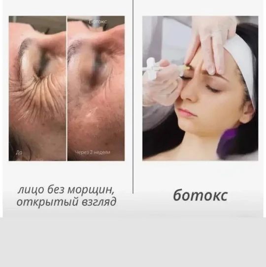 &
