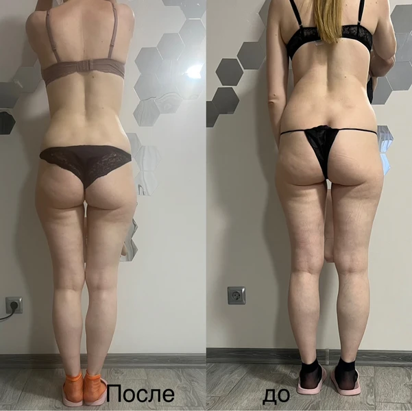 &