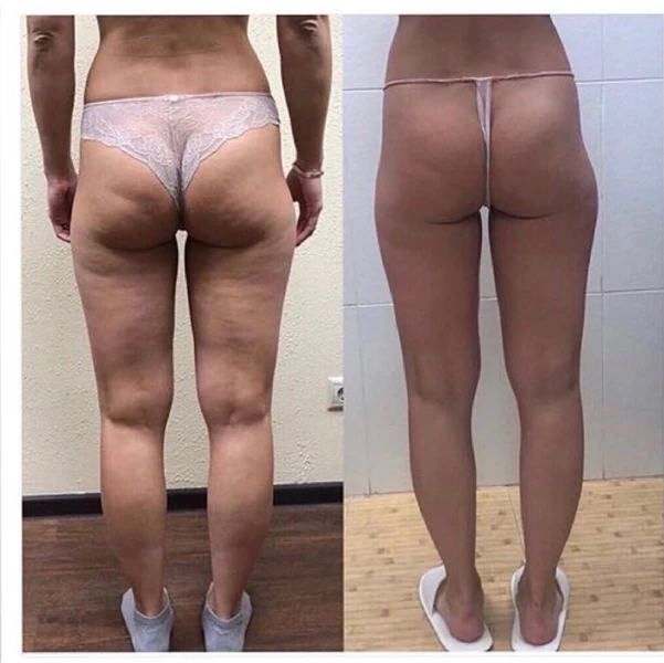 &