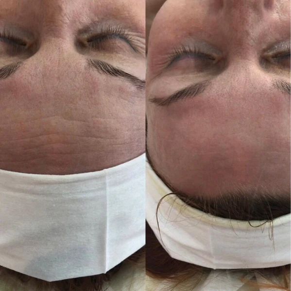 &