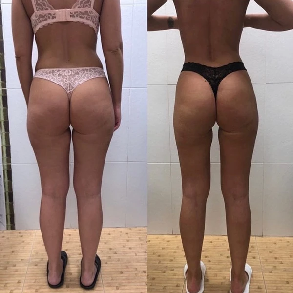 &