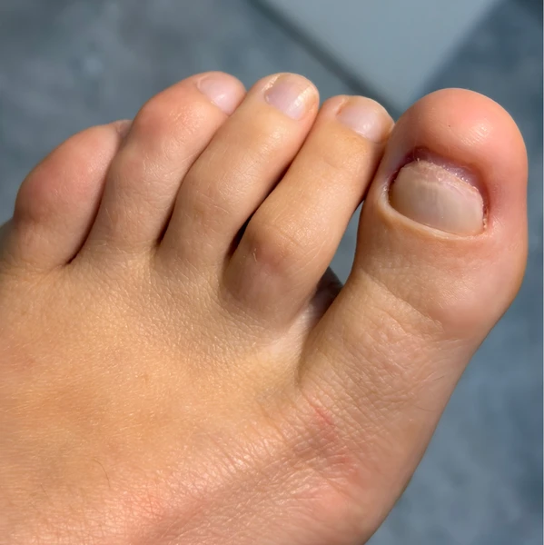 &