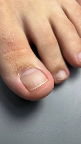 &