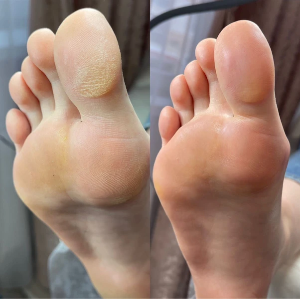 &