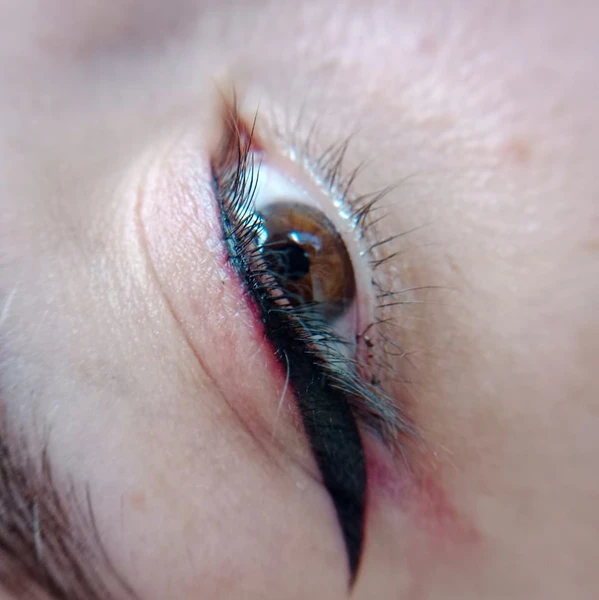 &