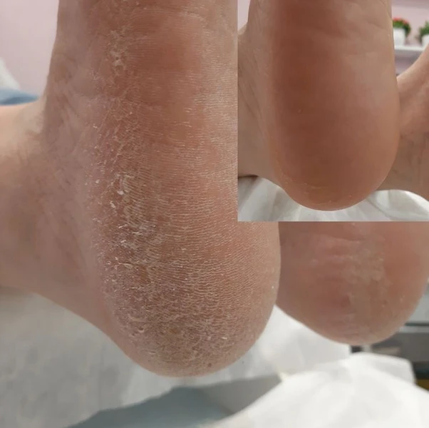 &