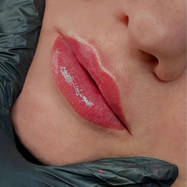 &