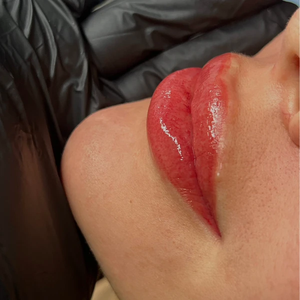 &