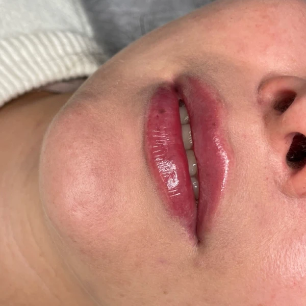 &