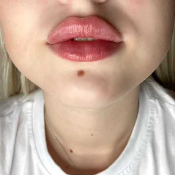 &