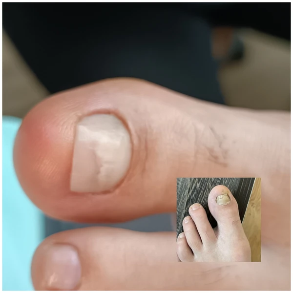 &