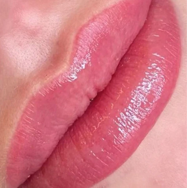 &