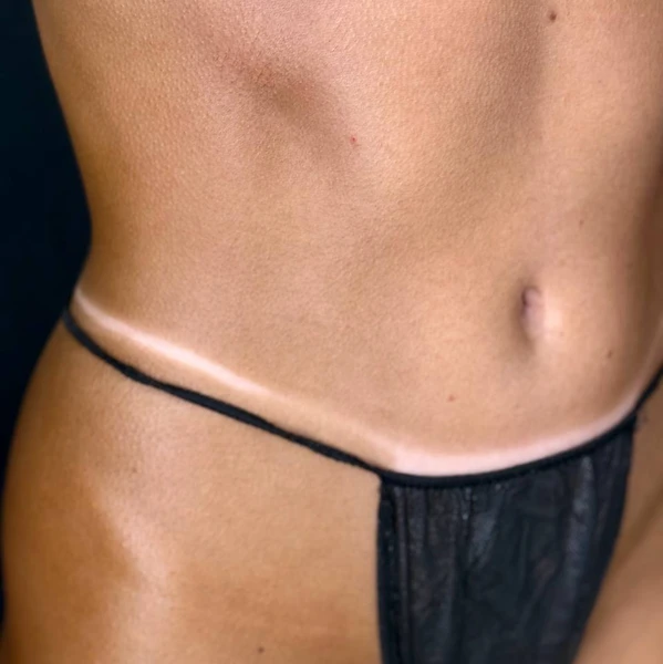 &