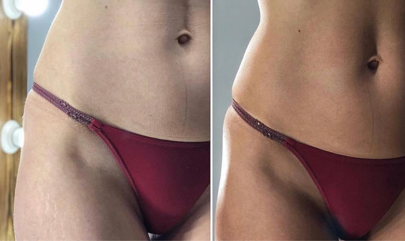 &