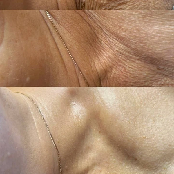 &