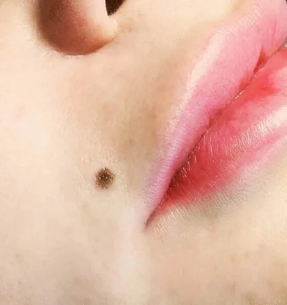 &