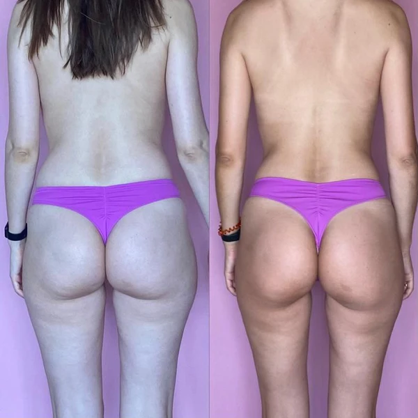 &
