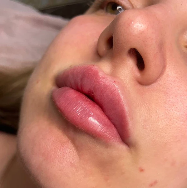 &