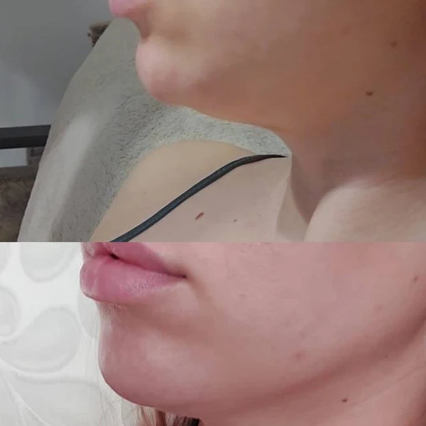 &
