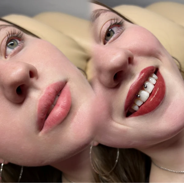&