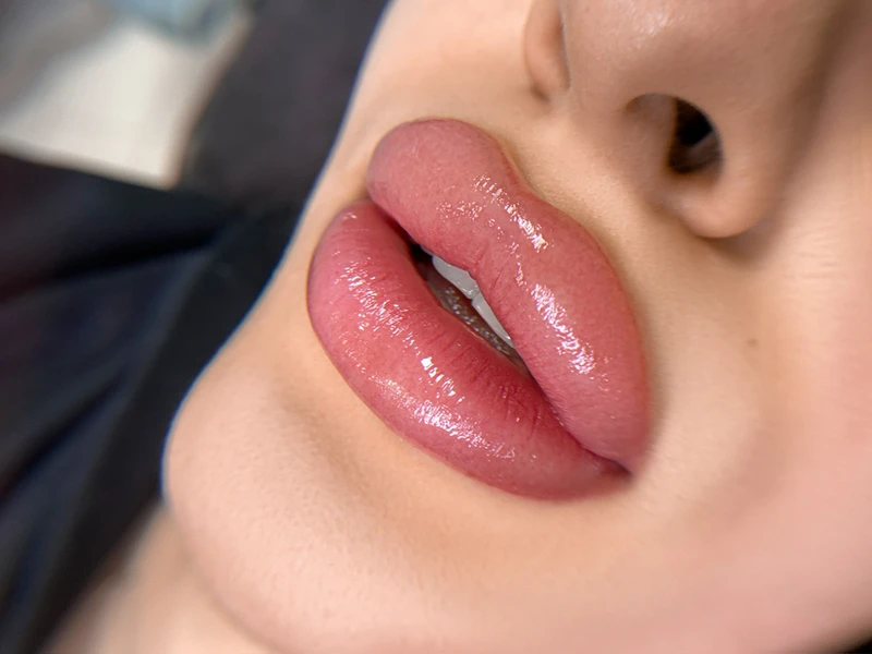 &